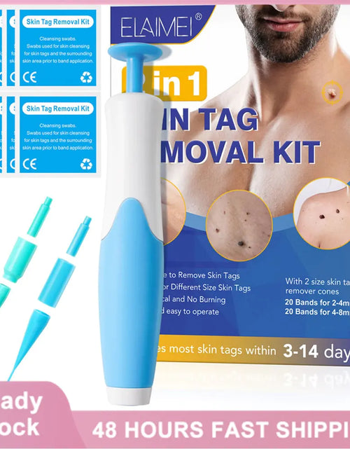 Load image into Gallery viewer, Skin Tag Remover Kit
