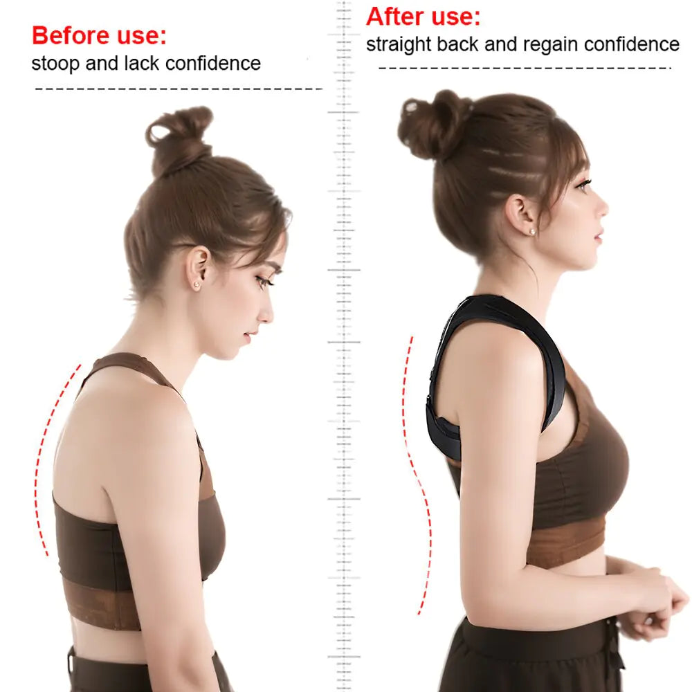 Posture Corrector - PosturePro