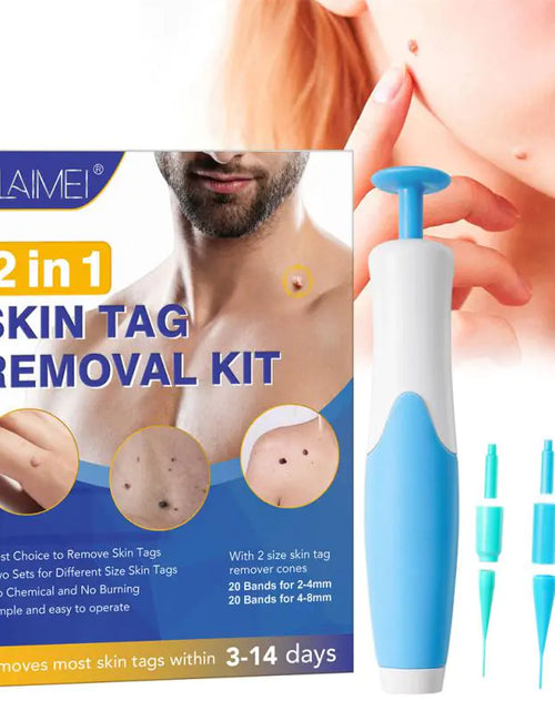 Load image into Gallery viewer, Skin Tag Remover Kit
